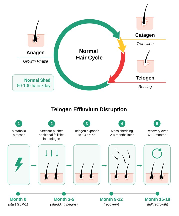 GLP-1 hair loss diagram